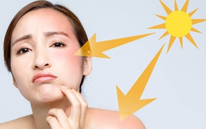 Đây là cách hấp thụ vitamin D mà không bị rám nắng