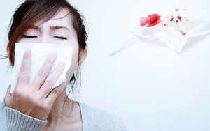 Nghẹt mũi nặng, khó thở không hẳn là cảm lạnh - có thể bạn đã bị viêm xoang! 3 thói quen khiến bệnh dễ "ghé thăm"