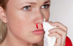 Khô mũi, chảy máu mũi trong ngày hanh khô: Cách chăm sóc và ngăn ngừa hiệu quả