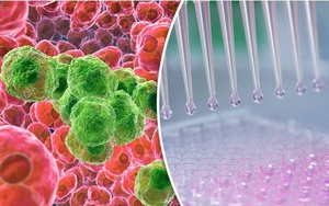 Tế bào ung thư sợ gì nhất?: Phát hiện nhiều 'điểm yếu' để loại bỏ tế bào ung thư