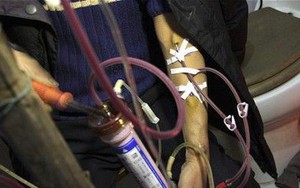 Nam kỹ sư 26 tuổi đột ngột phát hiện suy thận giai đoạn 4 sau lần đi khám đau ngón chân