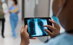 Những người có "phổi sạch" thường có 5 đặc điểm. Nếu bạn có 4 trong số đó, thì xin chúc mừng!