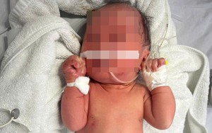 Hà Nội: Bé gái sơ sinh bị bỏ rơi ở bụi chuối, trên người nhiều vết xước và côn trùng đốt