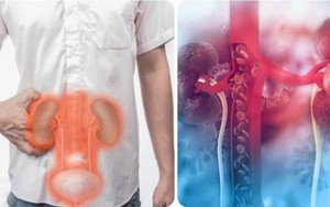 Thanh niên 20 tuổi suy thận giai đoạn cuối thừa nhận một sai lầm nhiều người Việt mắc phải