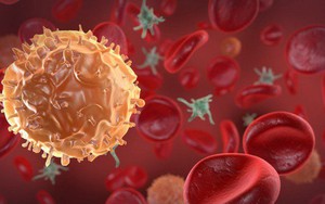 Thực phẩm làm tăng nguy cơ hình thành tế bào ung thư đại trực tràng, người Việt không nên lạm dụng