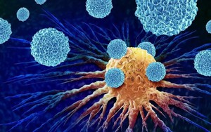 Loại rau được mệnh danh 'hoàng đế', người Việt nên ăn để hỗ trợ ngăn ngừa tế bào ung thư