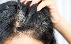 Liệu người tóc bạc ít khả năng mắc ung thư hơn? Có bằng chứng khoa học nào không? Câu trả lời đã có ở đây