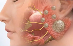 Người phụ nữ 38 tuổi âm thầm một mình chiến đấu với ung thư, thừa nhận 1 sai lầm nhiều người Việt mắc phải