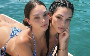 Sự thật khó tin về cặp song sinh dính liền thân đang gây bão mạng