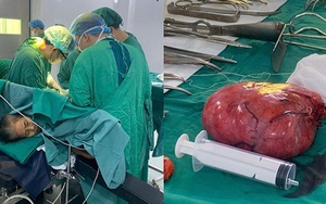 Phẫu thuật thành công khối u sau phúc mạc khổng lồ nằm ở vị trí phức tạp