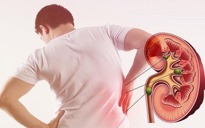 Người đàn ông 35 tuổi mắc suy thận mạn tính từ những món ăn quen thuộc tại hàng quán