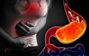 5 loại trái cây ít chua được chuyên gia khuyên dùng cho người trào ngược dạ dày: Vừa dễ tiêu hóa, vừa hỗ trợ giảm khó chịu