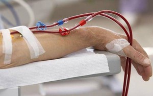 Người phụ nữ huyết áp tăng cao, đi khám phát hiện suy thận giai đoạn 4 vì 1 sai lầm nhiều người Việt mắc phải