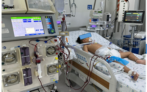Bé trai 4 tuổi suy gan cấp, phải lọc máu liên tục vì được cho uống paracetamol hạ sốt 3 tiếng/lần