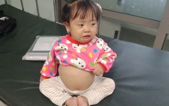Sự sống mong manh của bé gái bụng to như trống vì bệnh hiểm nghèo