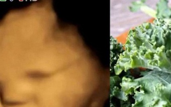 Thai nhi có thể 'nếm' thức ăn từ trong bụng mẹ