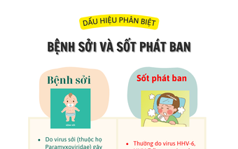 Hướng dẫn cách phân biệt bệnh sởi và sốt phát ban ở trẻ