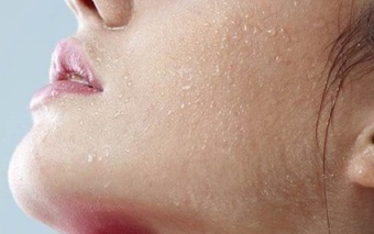 Nếu da khô, bong tróc, cẩn thận dấu hiệu của suy giáp và 5 dấu hiệu bất thường trên da cảnh báo sức khỏe