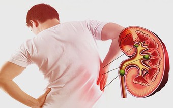 5 dấu hiệu cảnh báo bệnh thận mạn tính: Đừng bỏ qua nếu sáng dậy thấy bất thường này