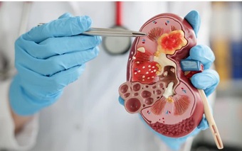 7 loại trái cây tốt cho thận, người bệnh suy thận nên ăn để duy trì chức năng thận