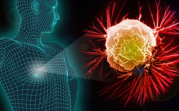 Tế bào ung thư 'thích' gì nhất? 4 nhóm thực phẩm được nghiên cứu có lợi trong việc giảm nguy cơ ung thư