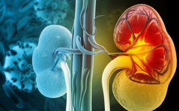 7 dấu hiệu suy thận giai đoạn đầu dễ nhận biết nhưng người Việt thường bỏ qua