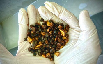 Kỳ lạ thứ thừa ra trong bụng con bò lại được định giá đắt hơn cả vàng