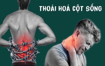 3 thói quen thường gặp là 'vua bào mòn' cột sống: Bác sĩ cảnh báo đau âm ỉ kéo dài ở 2 vùng này thì phải khám ngay kẻo muộn
