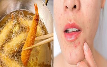 Chị em nên ăn rất ít 4 loại thức ăn yêu thích này nếu không muốn sụt giảm collagen, da xấu và nhanh già