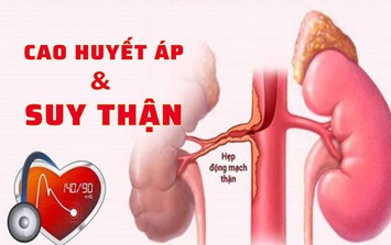 Huyết áp tăng cao, người phụ nữ 39 tuổi đi khám bất ngờ phát hiện nguy cơ mắc bệnh thận mạn