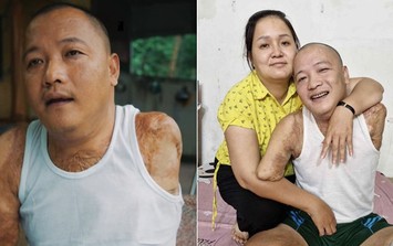 Mất 2 tay 1 chân sau tai nạn, người đàn ông tìm lại cuộc đời nhờ tình yêu của vợ