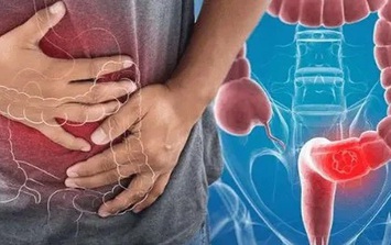 Người đàn ông phát hiện ung thư đại tràng từ dấu hiệu dễ bị nhầm lẫn, rất nhiều người Việt đã bỏ qua