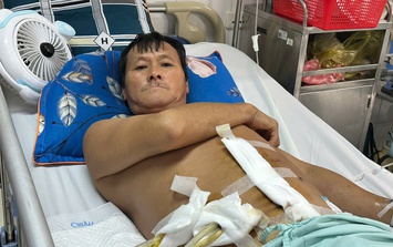 MS 1001: Hoàn cảnh khó khăn của gia đình người đàn ông dân tộc H'Mông cần được giúp đỡ để điều trị bệnh