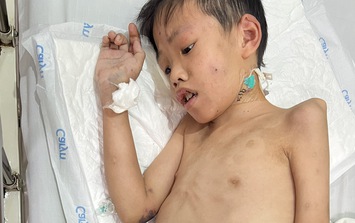 MS 1012: Con lớn bị tâm thần, người cha nghèo cầu cứu cộng đồng để điều trị cho con trai út mắc bệnh hiếm gặp
