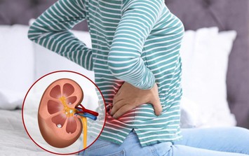 Dấu hiệu cảnh báo suy thận người Việt không nên bỏ qua
