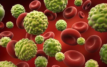 Tế bào ung thư 'thích' gì nhất? 4 nhóm thực phẩm người Việt cần hạn chế để giảm nguy cơ mắc bệnh