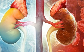 Đừng đợi đến khi chạy thận mới hối hận: 5 tín hiệu 'cầu cứu' từ thận bị 90% người bệnh bỏ qua