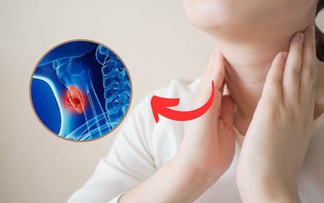 Hai chị em lần lượt phát hiện ung thư tuyến giáp từ việc làm nhiều người Việt bỏ qua