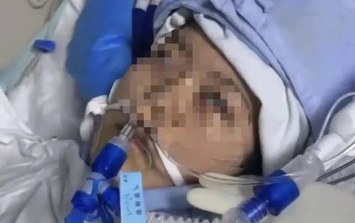 Cô gái 24 tuổi đột ngột ngừng tim sau buổi phỏng vấn xin việc: 5 dấu hiệu cảnh báo không nên bỏ qua