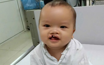 MS 1099: Bé trai 8 tháng tuổi bị bỏ rơi trước cổng chùa cần trợ giúp để phẫu thuật dị tật