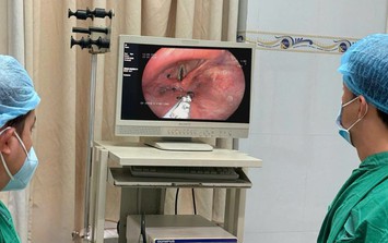 Người đàn ông 56 tuổi bị kiến chui vào thanh quản từ 1 việc không ngờ tới