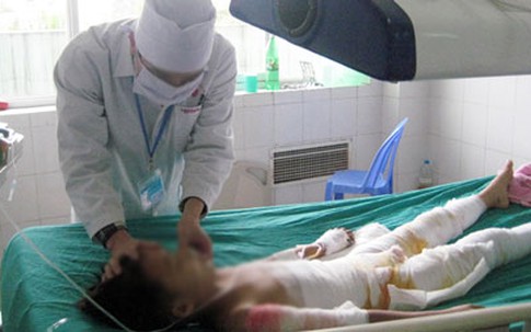 Vì con ăn gói mì tôm của bà, bố dùng rơm đốt con