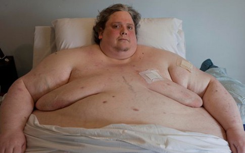 Người đàn ông béo nhất thế giới qua đời ở tuổi 44