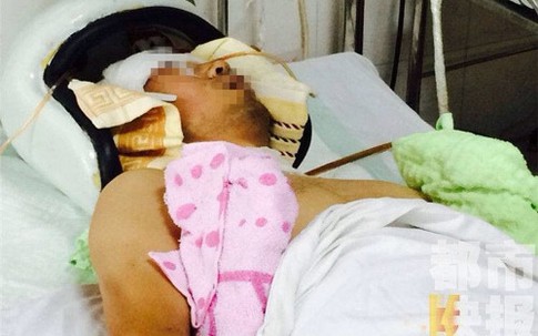 Chụp trộm nữ sinh tắm, thầy giáo bị đánh gần chết