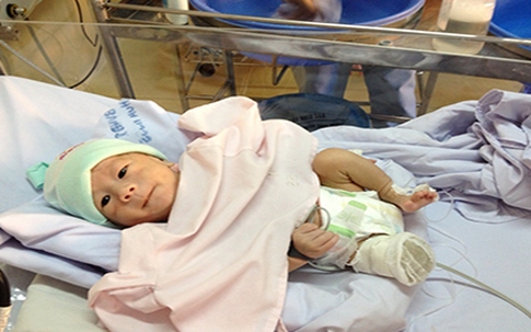 Bé sơ sinh văng khỏi bụng mẹ xuất viện
