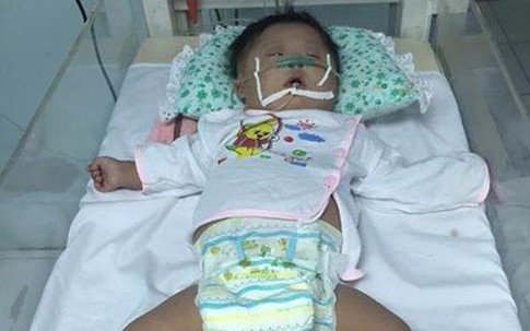 Bé gái sơ sinh mắc bệnh Down bị mẹ bỏ lại bệnh viện