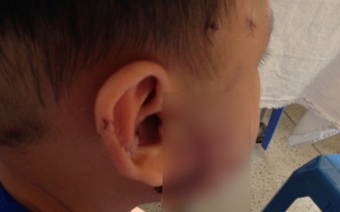 Rùng mình bé 3 tuổi bị gấu nuôi cắn rời tay: Hiểm họa thú dữ trong nhà