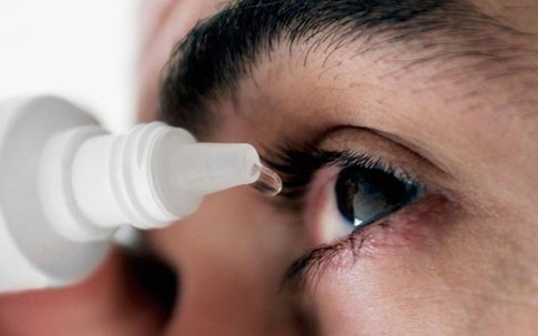 Tia máu trong mắt là bệnh gì?