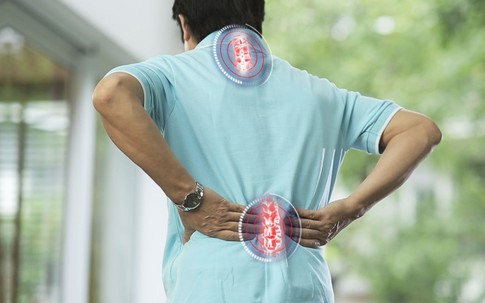 Bài thuốc xương khớp bí truyền, hiệu quả vượt trội điều trị thoái hóa, vôi hóa, gai đôi đốt sống cổ, đốt sống lưng