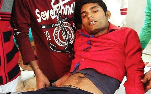 Người đàn ông bị thanh sắt cắm sâu vào “chỗ hiểm”